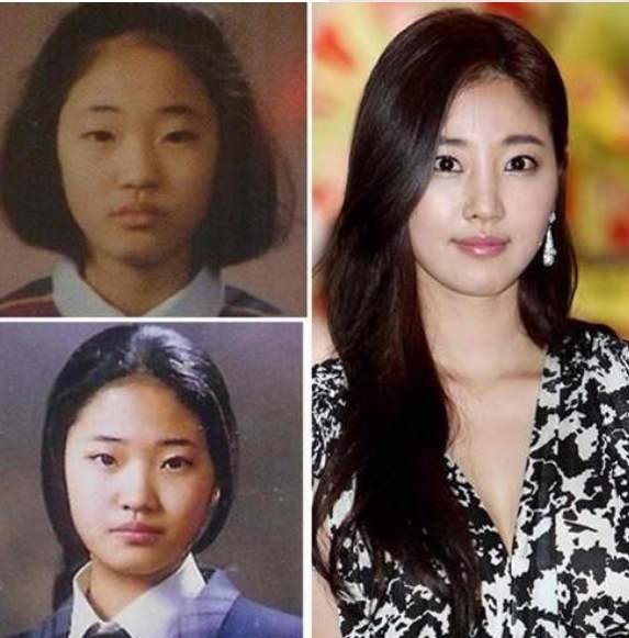 Celebrities Before And After Plastic Surgery.